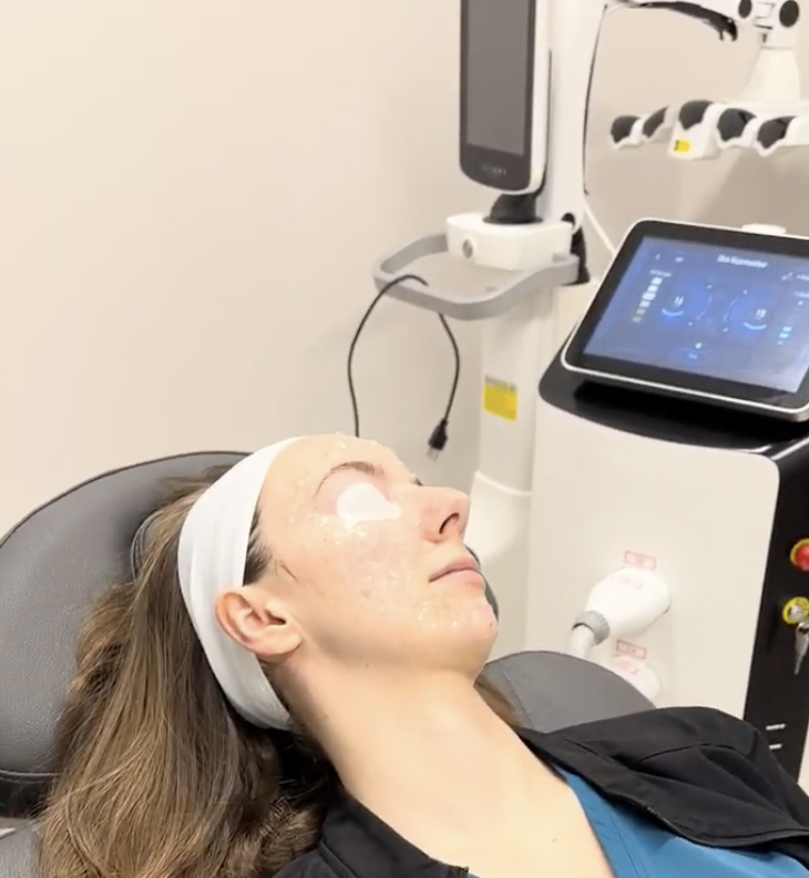 IPL dry eye treatment available near Piney Flats, TN